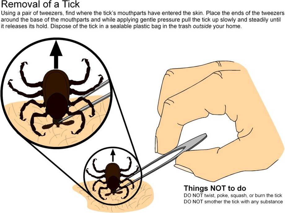 Remove A Tick Diagram